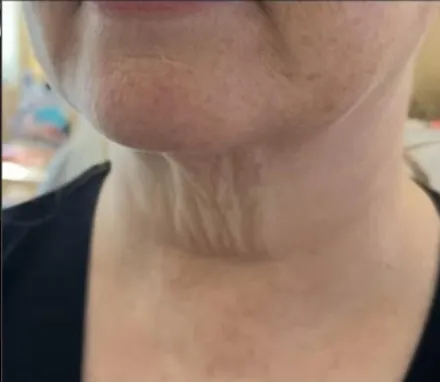 Screenshot-2024-01-16-at-2-39-03-PM-before