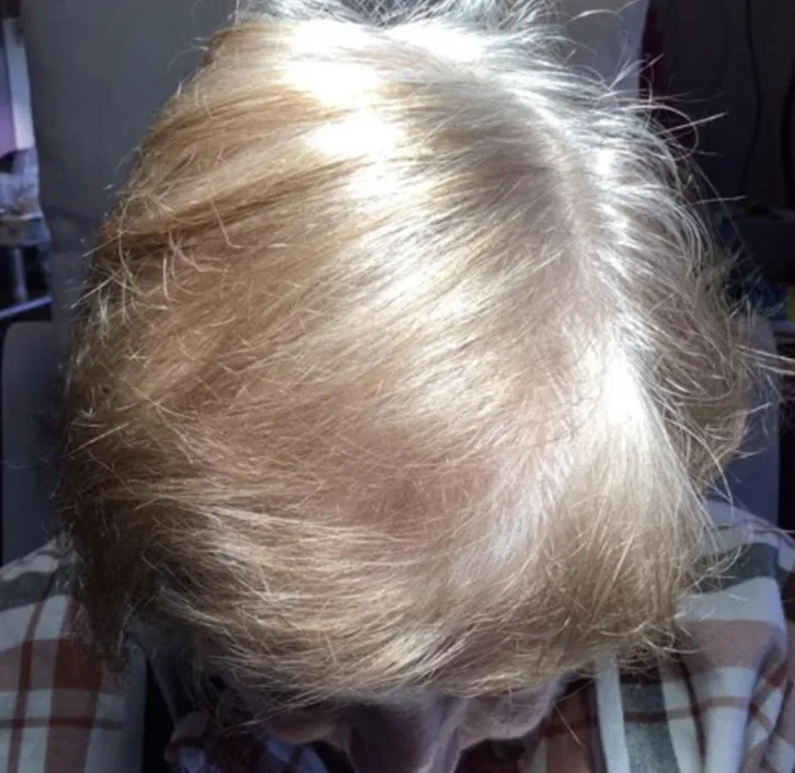 Screenshot-2024-01-16-at-3-03-29-PM-after