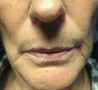 Screenshot-2024-01-16-at-3-51-11-PM-BEFORE