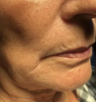 Screenshot-2024-01-16-at-3-51-28-PM-BEFORE