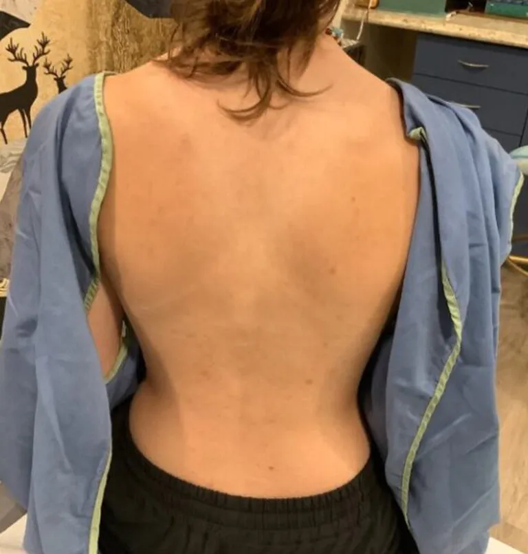 after_peels-768×805