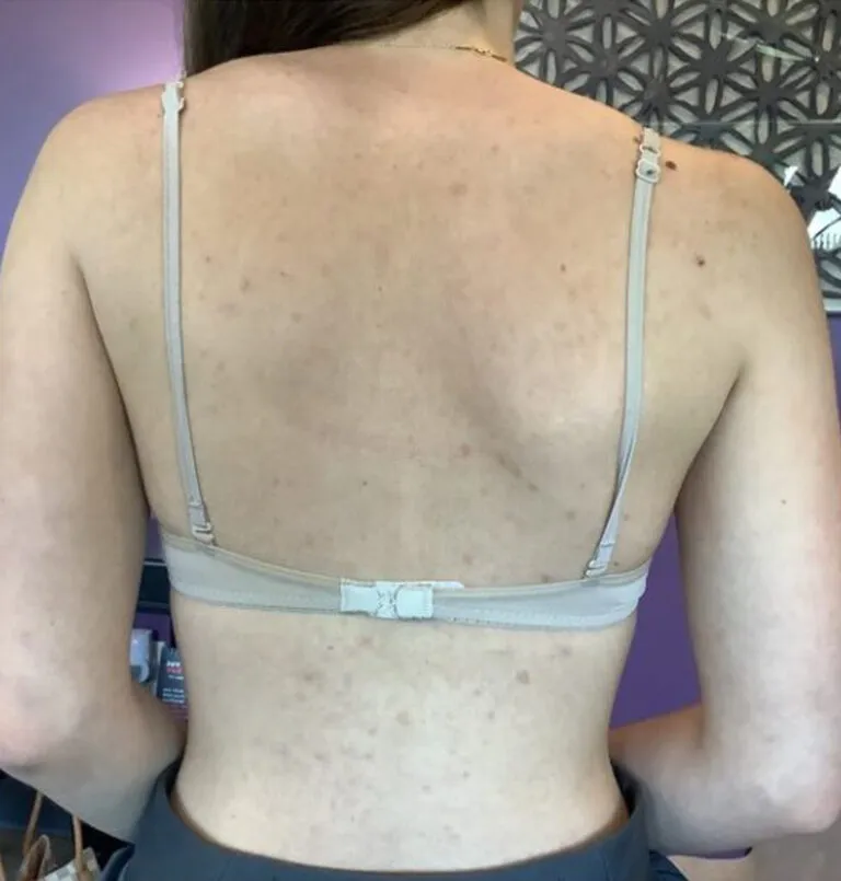 before_peels-768×805