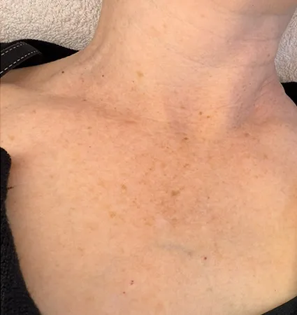 bbl-chest-01