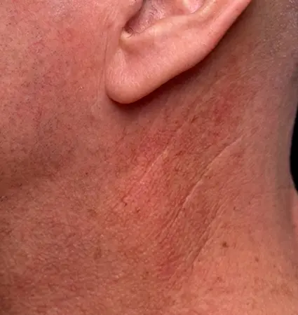 bbl-neck-01