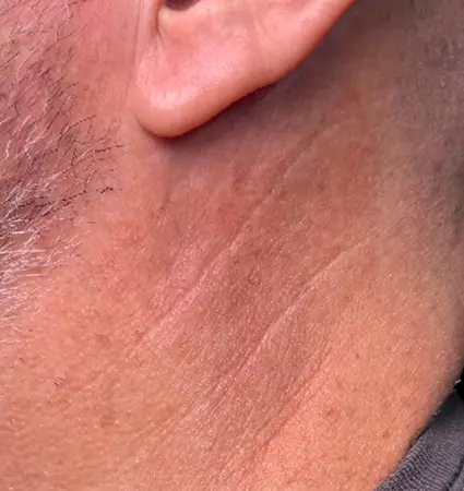 bbl-neck-02