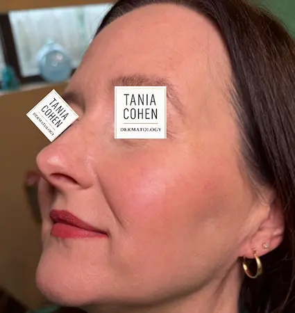 fillers-pat-A-16