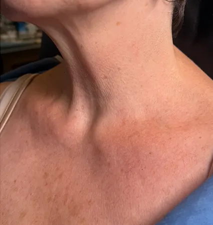 pdo-threads-neck-pat-A-03
