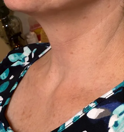 pdo-threads-neck-pat-A-04