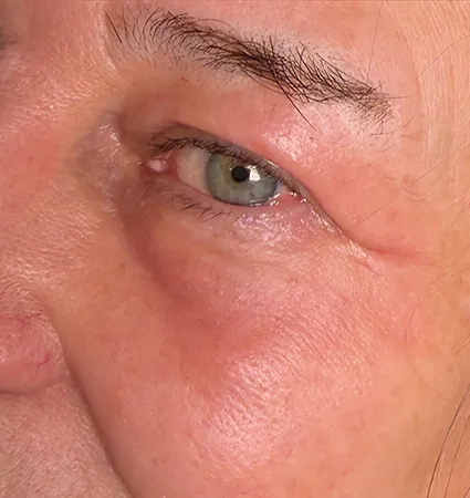 profractional-trl-pat-A-10