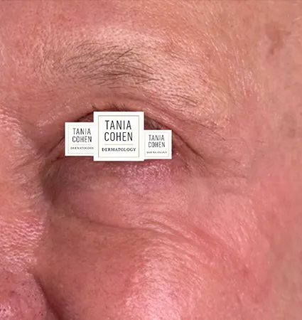 profractional-trl-pat-B-08