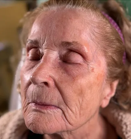 tranformation_botox-fillers-80yrs-07