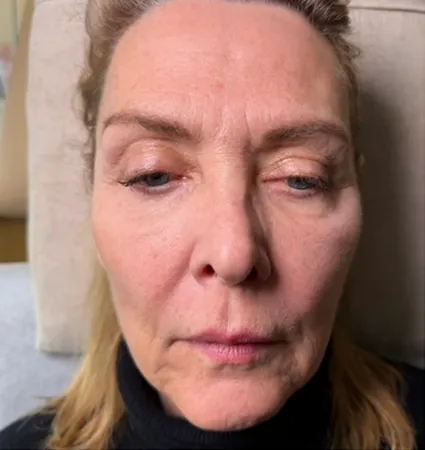 tranformation_lasers-fillers-01