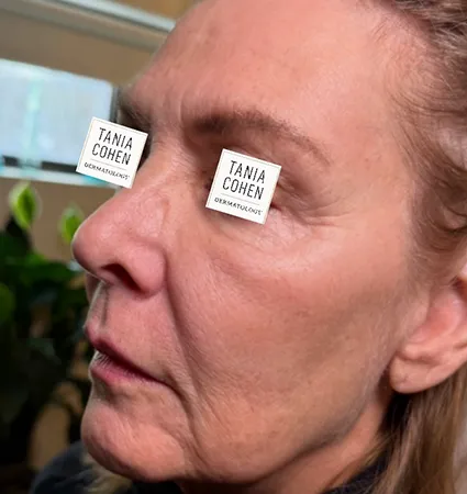 tranformation_lasers-fillers-17