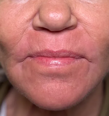 trl-mouth-10
