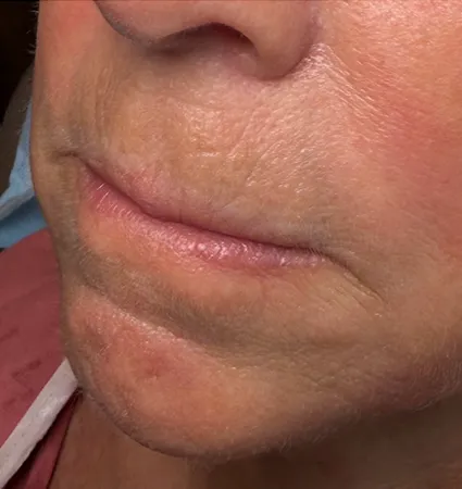 trl-mouth-pat-2-01