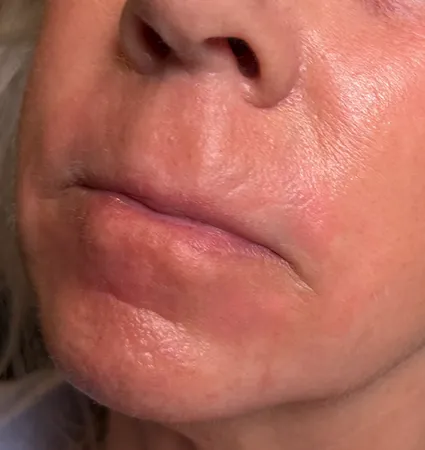 trl-mouth-pat-2-02