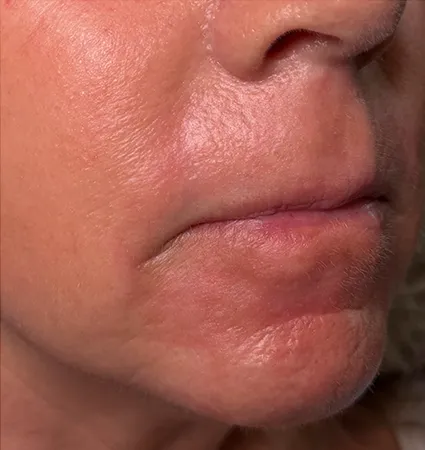 trl-mouth-pat-2-06